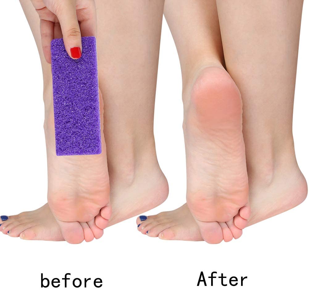 Double Sided Pumice Stone Callus, Hard Skin Callus Remover and Scrubber Pedicure Tools Foot File for Feet Hands Exfoliator Pedicure Feet File